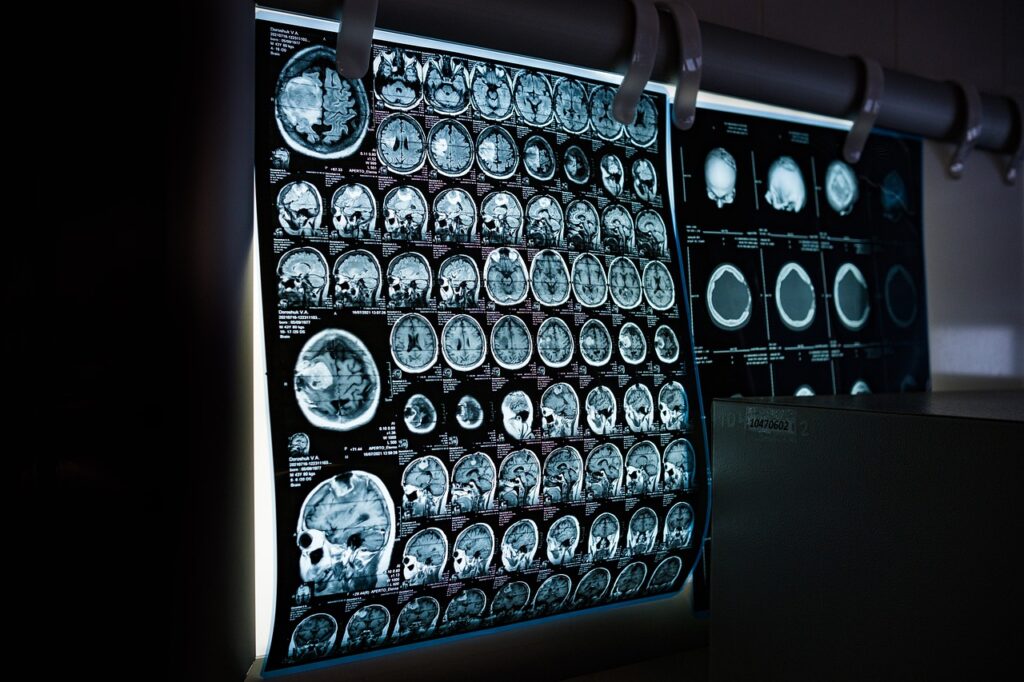 Ernia Inguinale - X-rays